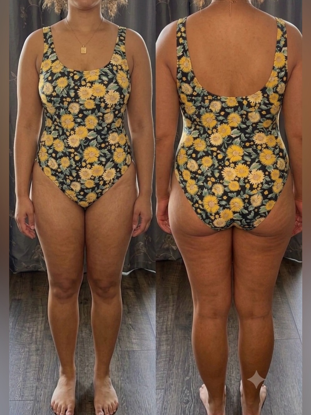 Scoop-Back One-Piece Swimsuit in Yellow Floral on Black